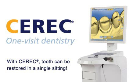 CEREC technology allows for teeth restoration, such as crowns, inlays and onlays to be done in one dental appointment in SW Calgary